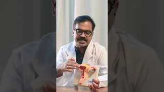 Some misconcept about sterilization