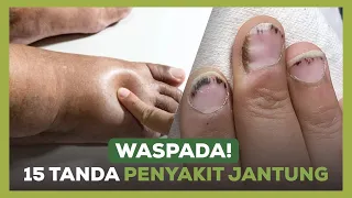 Bukan Cuma Nyeri Dada! Ini 15 Sinyal Tubuh Pertanda Masalah Jantung