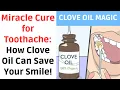 How To Use Clove Oil For Tooth Cavity Pain Relief