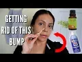 How To Get Rid Of Nose Piercing Bump Mini Haul GIVEAWAY JuicyJas