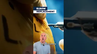 See How Doctors Fix a Broken Elbow With Metal Parts
