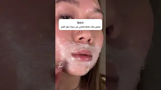 علاج تصبغات واستمرار حول الفم 