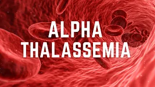 Download Alpha Thalassemia - Symptoms ,diagnosis and pathology. MP3