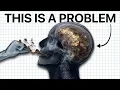 The American Healthcare Scam Explained