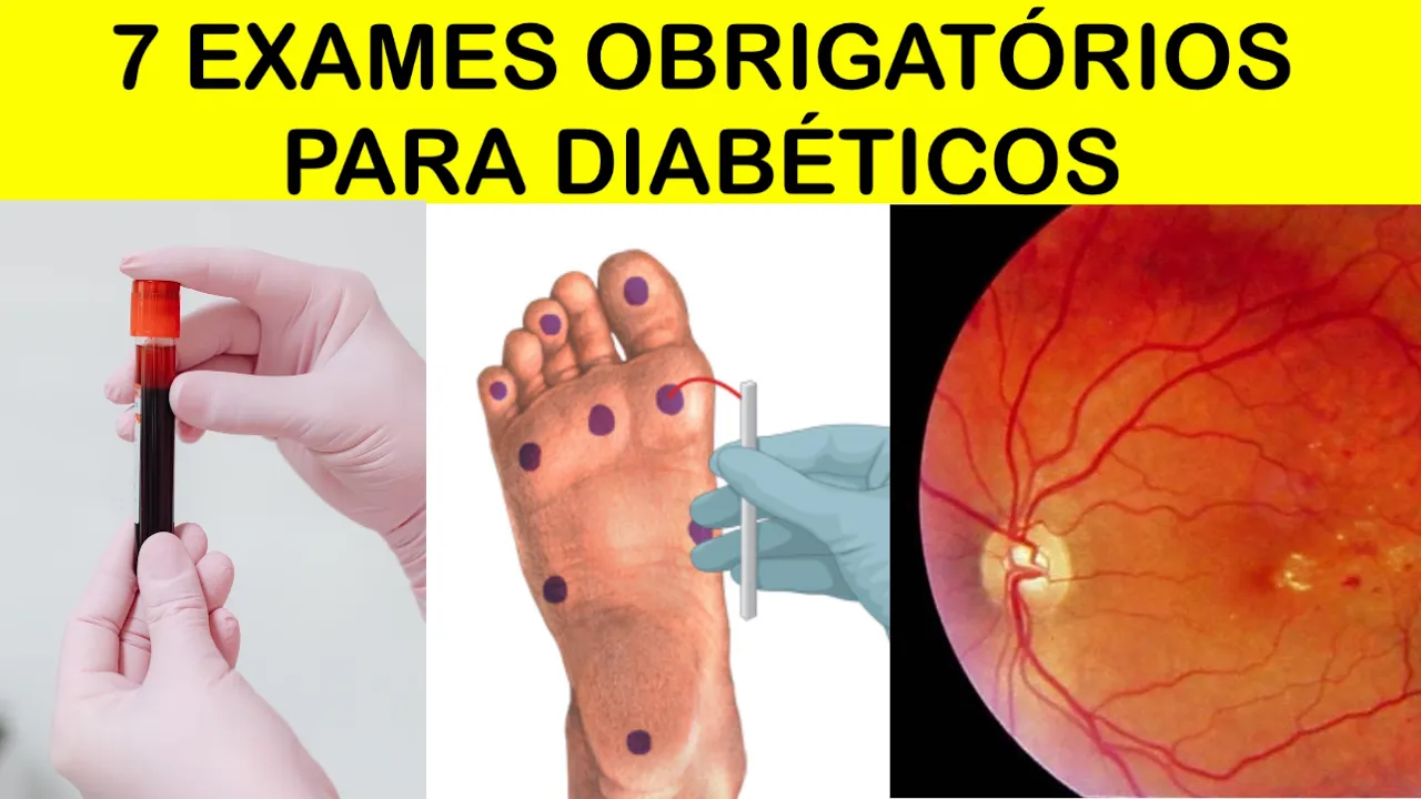 7 EXAMES OBRIGATÓRIOS para DIABÉTICOS (o último reduz muito o risco de morte no Diabetes)