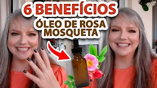 ÓLEO DE ROSA MOSQUETA como age na Pele Madura