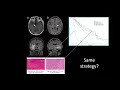 CGC Webinar Transforming Tumor Methylation Profiling with Oxford Nanopore Direct DNA Sequencing
