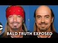 Poison s Bret Michaels Hiding Baldness With Bandana