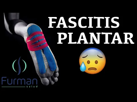 Download MP3 FASCITIS PLANTAR 🦶 Dolor en la planta del pie [Causas | Síntomas | Tratamientos]