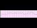 Latent Constraints C Major High Density Transformation