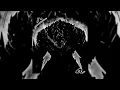 Download Lagu ℍ𝔸ℍ𝔸ℍ𝔸, 𝕊𝔼𝕌𝕊 𝕆𝕊𝕊𝕆𝕊 𝔼𝕊𝕋Ã𝕆 ℚ𝕌𝔼𝔹ℝ𝔸𝔻𝕆𝕊 𝕦𝕝𝕥𝕣𝕒 𝕤𝕝𝕠𝕨𝕖𝕕 𝕝𝕠𝕠𝕡𝕖𝕕