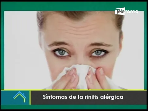 Síntomas de la rinitis alérgica