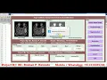Matlab Code for Brain Tumor Type Detection and Classification Using Image Processing