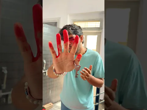 चाबी के वजह से आंख में यह क्या?हो गया।