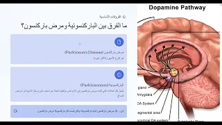    الشلل الرعاش أم الباركنسونية  الفرق الذي يجهله الكثيرون   دندنها