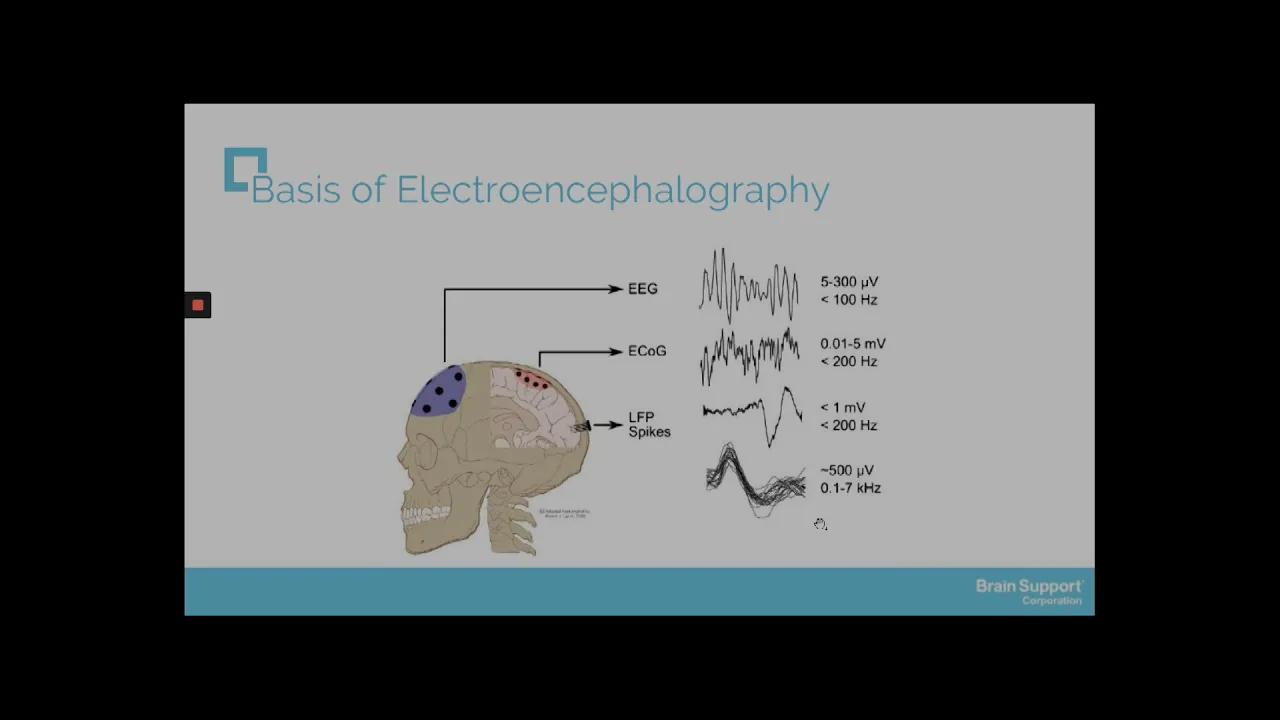Curso de Electroencefalografía | Módulo 1