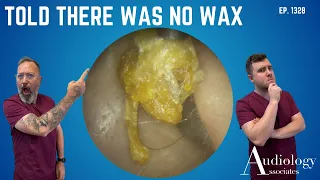 Told There Was No Wax – Then Hidden Fluid Behind the Eardrum – EP1328