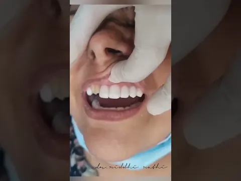 Smile design video testimonial
