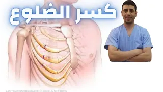 كسر ضلع كسور الضلوع كيفية علاج كسور الضلوع دكتور احمد حسن جمعه 