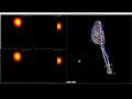 OpenSim Upper Limb Mechanical Model With Afferent Feedback and CPG in MIIND
