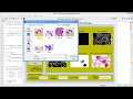 Matlab Code for Early Stage Blood Cancer Detection Using Image Processing