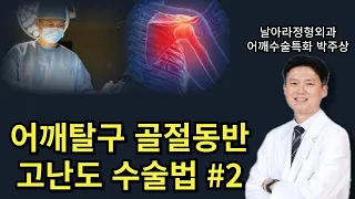 어깨탈구 동반된 대결절골절 수술치료법
