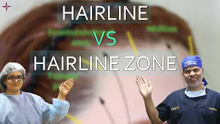 What's "HAIRLINE ZONE”: New Terminology by Drs Bansal & Sethi @EugenixHairSciencesofficial