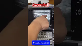 อาการปวดและบวมที่ข้อมือเกิดจากสาเหตุอะไร