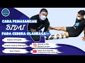 Download Lagu Pertolongan Pertama: Tehnik Pemasangan Bidai Pada Patah Tulang Download Lagu Pertolongan Pertama: Tehnik Pemasangan Bidai Pada Patah Tulang