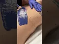 Professional waxing male back using hard wax starflex from Starpil