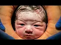 Download Lagu Natuurlijke bevalling – Wat gebeurt er echt tijdens de bevalling (stap-voor-stap visualisatie van...
