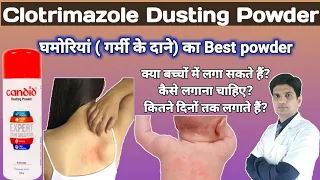 Download Clotrimazole dusting powder | Nuforce powder in hindi | Candid powder for baby MP3