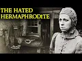 The Shocking Case of the Hated Hermaphrodite Herculine Barbin