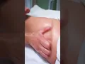 Lymphatic Drainage Massage