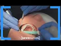 Drug to regrow teeth may be on market by 2030 NewsNation Live