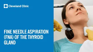 Fine Needle Aspiration FNA of the Thyroid Gland