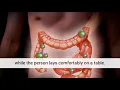 Colon Detox Benefits Vita Wellness Spa