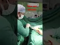 Download Lagu Tibia nail removal | Tibia bone fracture| Leg bone rod removal | Bone rod removal #bone #fracture