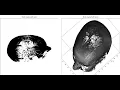 Medical Imaging 3D Mesh visualization Head MRI images python libraries
