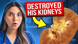 Healthy Snack DESTROYED His KIDNEYS: Medical Mystery Solved