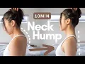 Download Lagu 10min Fix Neck Hump \u0026 Forward Head | Correct Posture | Best Neck Stretch