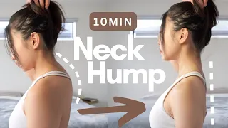10min fix neck hump u0026 forward head correct posture best neck stretch