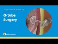G-Tube Surgery