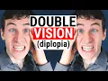 What Causes DOUBLE VISION Diplopia 5 Common Causes for Diplopia Doctor Eye Health