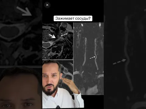 Зажимает сосуд в шее?