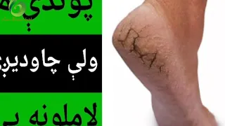 پوندې مو ولي چاودیږې لاملونه يې 