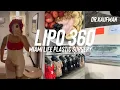 Plastic Surgery Vlog Lipo 360 Vlog with Dr Kaufman Miami Life Plastic Surgery