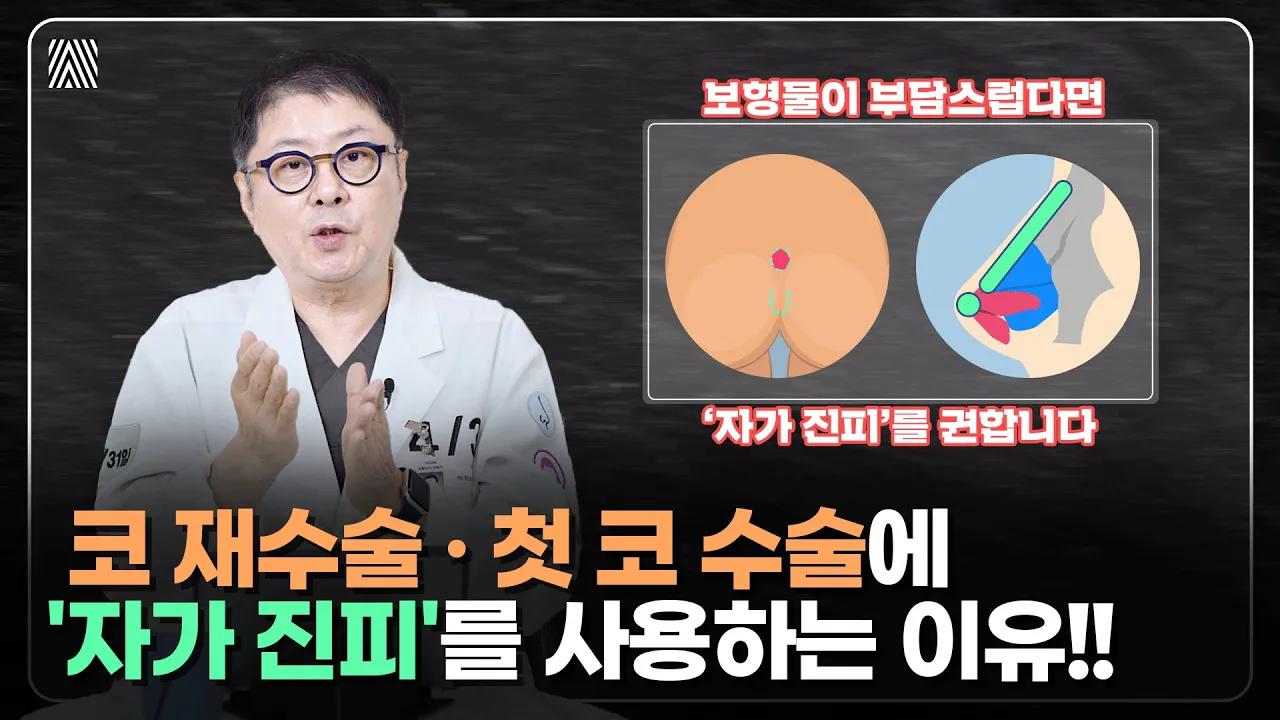 보형물이 부담스럽고 자연스로운 코를 원한다면? '자가 진피'의 종류와 장단점 완벽 분석!! 자가 진피 1편_[4월31일 성형외과]