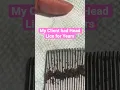 Download Lagu Head Lice for Years 😱 l Lice Removal Service @staceythelouselady #explore #lice #hair