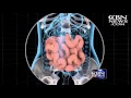 Leaky Gut Got You Down How to Reverse Autoimmune Disease
